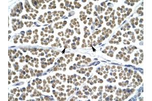 GABRD antibody was used for immunohistochemistry at a concentration of 4-8 ug/ml to stain Skeletal muscle cells (arrows) in Human Muscle. (GABRD Antikörper  (N-Term))