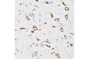 Immunohistochemistry of paraffin-embedded rat brain using RPS20 Rabbit mAb (ABIN7270017) at dilution of 1:100 (40x lens). (RPS20 Antikörper)