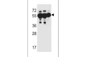 ANKRD57 Antibody (C-term) (ABIN651987 and ABIN2840483) western blot analysis in MDA-M,HepG2,A549 cell line lysates (35 μg/lane). (ANKRD57 Antikörper  (C-Term))