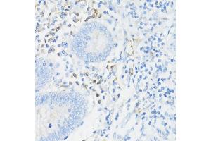 Immunohistochemistry (IHC) image for anti-Integrin alpha-L (ITGAL) (AA 26-306) antibody (ABIN3015542)