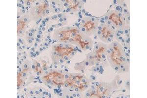 IHC-P analysis of kidney tissue, with DAB staining. (ABCC6 Antikörper  (AA 1260-1502))
