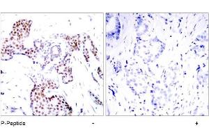 Image no. 1 for anti-ELK1, Member of ETS Oncogene Family (ELK1) (pSer389) antibody (ABIN196678) (ELK1 Antikörper  (pSer389))