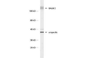 dilution: 1 : 1000, sample: synaptic membrane fraction of rat brain (LP1) (LRFN1 Antikörper)