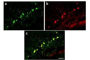 Image no. 1 for anti-Green Fluorescent Protein (GFP) antibody (ABIN346938) (GFP Antikörper)