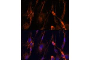 Immunofluorescence analysis of C6 cells using BFAR Polyclonal Antibody (ABIN6127492, ABIN6137542, ABIN6137543 and ABIN6224322) at dilution of 1:100 (40x lens).