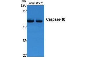 Western Blotting (WB) image for anti-Caspase 10, Apoptosis-Related Cysteine Peptidase (CASP10) (Internal Region) antibody (ABIN3187650)