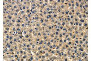 ABIN6257996 and ABIN6275136 at 1/100 staining Rat liver tissue by IHC-P. (FUT3 Antikörper  (Internal Region))