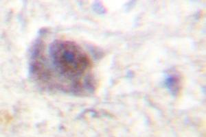 Image no. 1 for anti-Adenomatous Polyposis Coli (APC) antibody (ABIN271993) (APC Antikörper)