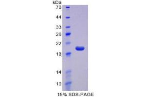 SDS-PAGE (SDS) image for CD160 (CD160) (AA 33-171) protein (His tag) (ABIN1879075) (CD160 Protein (CD160) (AA 33-171) (His tag))