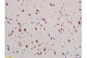 Formalin-fixed and paraffin embedded: rat brain tissue labeled with Anti-Nogo-R Polyclonal Antibody , Unconjugated at 1:200 followed by conjugation to the secondary antibody and DAB staining