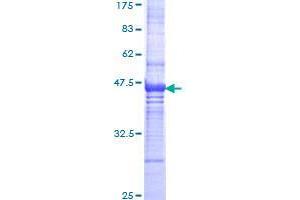 Image no. 1 for Unc-5 Homolog D (UNC5D) (AA 31-130) protein (GST tag) (ABIN1324658) (UNC5D Protein (AA 31-130) (GST tag))