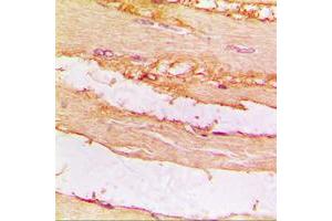 Immunohistochemical analysis of CKMT2 staining in human muscle formalin fixed paraffin embedded tissue section. (CKMT2 Antikörper  (Center))
