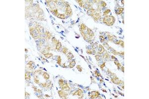 Immunohistochemistry of paraffin-embedded human stomach using DARS2 antibody. (DARS2 Antikörper  (AA 406-645))