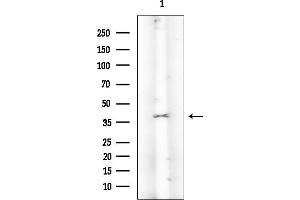 Western blot analysis of lysates from COLO205 cells(heat-shock treatment), using Annexin A2 Mouse Monoclonal Antibody at 1/1000 dilution.