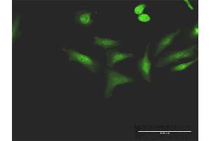 Immunofluorescence of purified MaxPab antibody to CCNT1 on HeLa cell. (Cyclin T1 Antikörper  (AA 1-726))