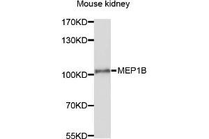 Western blot analysis of extracts of mouse kidney cells, using MEP1B antibody. (Meprin B Antikörper)