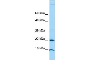 WB Suggested Anti-ADAT2 Antibody Titration: 1. (ADAT2 Antikörper  (N-Term))