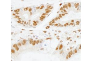 anti-Splicing Factor 3b, Subunit 1, 155kDa (SF3B1) (AA 200-250) antibody