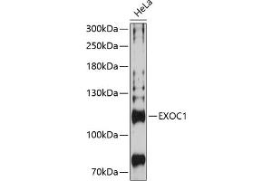 Western blot analysis of extracts of HeLa cells, using EXOC1 Antibody (ABIN6129575, ABIN6140361, ABIN6140362 and ABIN6224778) at 1:3000 dilution. (EXOC1 Antikörper  (AA 645-894))