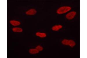 ABIN6267684 staining HT-1080 cells by ICC/IF. (Aurora Kinase B Antikörper  (pThr232))