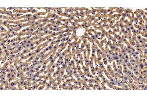 Detection of GHR in Rat Liver Tissue using Polyclonal Antibody to Growth Hormone Receptor (GHR) (Growth Hormone Receptor Antikörper  (AA 353-588))