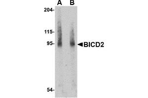 Western Blotting (WB) image for anti-Bicaudal D Homolog 2 (BICD2) (Middle Region) antibody (ABIN1030887) (BICD2 Antikörper  (Middle Region))