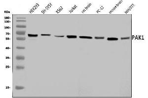 Western blot analysis of PAK1 using anti-PAK1 antibody (ABIN7599852).