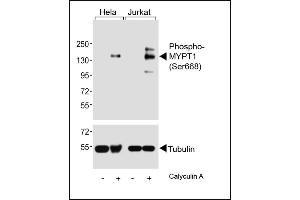 Western blot analysis of lysates from Hela, Jurkat cell line, untreated or treated with Calyculin A, 100nM, using (ABIN6241041 and ABIN6578962) (upper) or Tubulin (lower). (PPP1R12A Antikörper  (pSer668))
