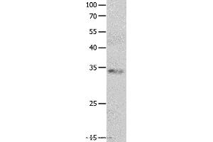 Western blot analysis of Jurkat cell, using RBFOX3 Polyclonal Antibody at dilution of 1:550 (NeuN Antikörper)