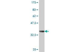 Western Blot detection against Immunogen (37. (IDS Antikörper  (AA 38-137))