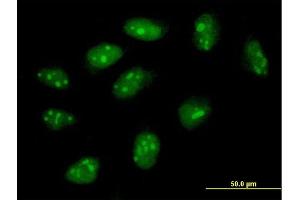 Immunofluorescence of purified MaxPab antibody to FLJ11184 on HeLa cell. (C4orf43 Antikörper  (AA 1-203))