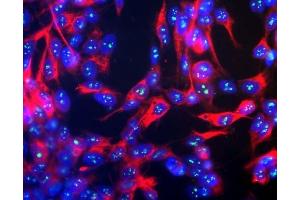 Human SH-SY5Y cells stained with ABIN1580417, showing prominent specular nucleolar staining. (Fibrillarin Antikörper)