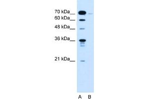 WB Suggested Anti-KLHL31 Antibody Titration:  0. (KLHL31 Antikörper  (C-Term))
