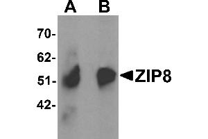 Western Blotting (WB) image for anti-Solute Carrier Family 39 (Zinc Transporter), Member 8 (SLC39A8) (C-Term) antibody (ABIN1030823) (SLC39A8 Antikörper  (C-Term))