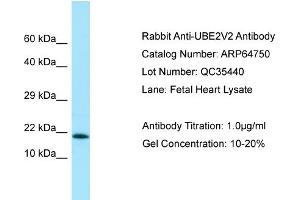 Western Blotting (WB) image for anti-Ubiquitin-Conjugating Enzyme E2 Variant 2 (UBE2V2) (C-Term) antibody (ABIN2774407) (UBE2V2 Antikörper  (C-Term))