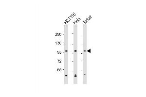 Western Blot at 1:2000 dilution Lane 1: HCT116 whole cell lysate Lane 2: Hela whole cell lysate Lane 3: Jurkat whole cell lysate Lysates/proteins at 20 ug per lane. (MANBA Antikörper  (AA 712-745))