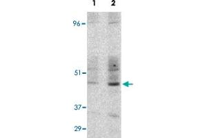 Western blot detection of GST-CD209 fusion protein expressed in E. (DC-SIGN/CD209 Antikörper  (Internal Region))