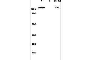 Lane 1: mouse brain lysates Lane 2: mouse embryo lysates probed with Anti GRM1 Polyclonal Antibody, Unconjugated (ABIN734663) at 1:200 in 4 °C. (mGluR1 + mGluR5 Antikörper  (AA 651-750))