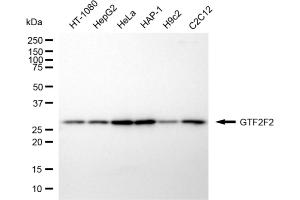 Western blotting analysis using GTF2F2 antibody (ABIN7798708). (Rekombinanter GTF2F2 Antikörper)