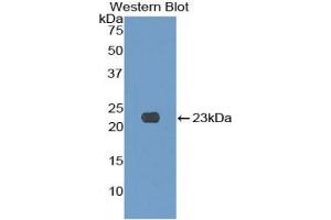 Detection of Recombinant KLRC2, Human using Polyclonal Antibody to Killer Cell Lectin Like Receptor Subfamily C, Member 2 (KLRC2) (KLRC2 Antikörper  (AA 19-190))