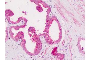 Anti-CD11c antibody IHC of human prostate. (CD11c Antikörper  (Internal Region))