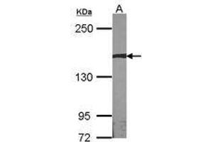 Image no. 1 for anti-Autism Susceptibility Candidate 2 (AUTS2) (AA 524-770) antibody (ABIN467523)