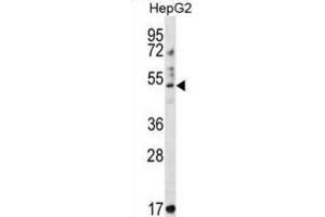 Western Blotting (WB) image for anti-Tripartite Motif Containing 11 (TRIM11) antibody (ABIN2997252) (TRIM11 Antikörper)