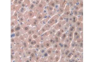 Immunohistochemistry (IHC) image for anti-serine/threonine Kinase 11 (STK11) (AA 49-309) antibody (ABIN1871221)