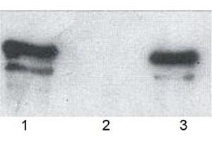 Western blot analysis of wild type p62, GST-tagged (human, recombinant) bound to: (1) glutathione-agarose and (3) ubiquitin-agarose (2: agarose control). (KHDRBS1 Antikörper  (AA 387-436))