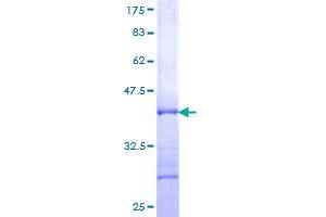Image no. 1 for Ribosomal Protein L10 (RPL10) (AA 1-100) protein (GST tag) (ABIN1318527)