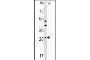 DHRS11 Antibody (Center) (ABIN1537768 and ABIN2849436) western blot analysis in MCF-7 cell line lysates (35 μg/lane). (DHRS11 Antikörper  (AA 115-142))