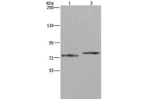 Western Blot analysis of Mouse heart tissue and 231 cell using AATF Polyclonal Antibody at dilution of 1:667 (AATF Antikörper)