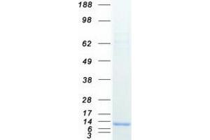 Western Blotting (WB) image for Coiled-Coil Domain Containing 23 (CCDC23) (Coiled coil domain) protein (Myc-DYKDDDDK Tag) (ABIN2712960)