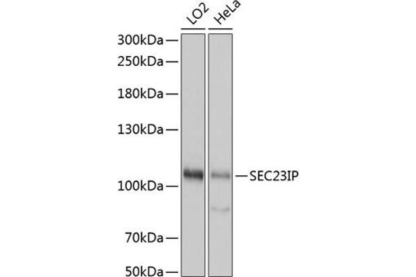 SEC23IP Antikörper  (AA 600-940)